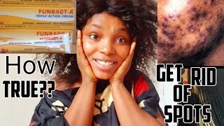 HOW TO USE: FUNBACT-A  CREAM ,SPOT/ECZEMA/PIMPLES FREE