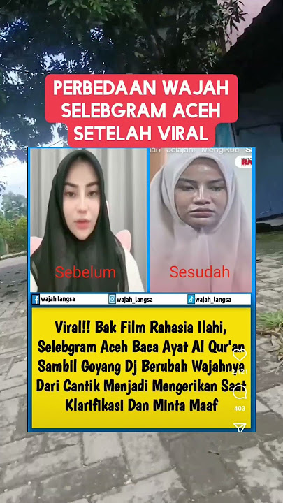 Perbedaan wajah selebgram Aceh setelah viral di sosmed‼️ #shorts #short #shortvideo