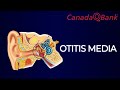 Otitis Media