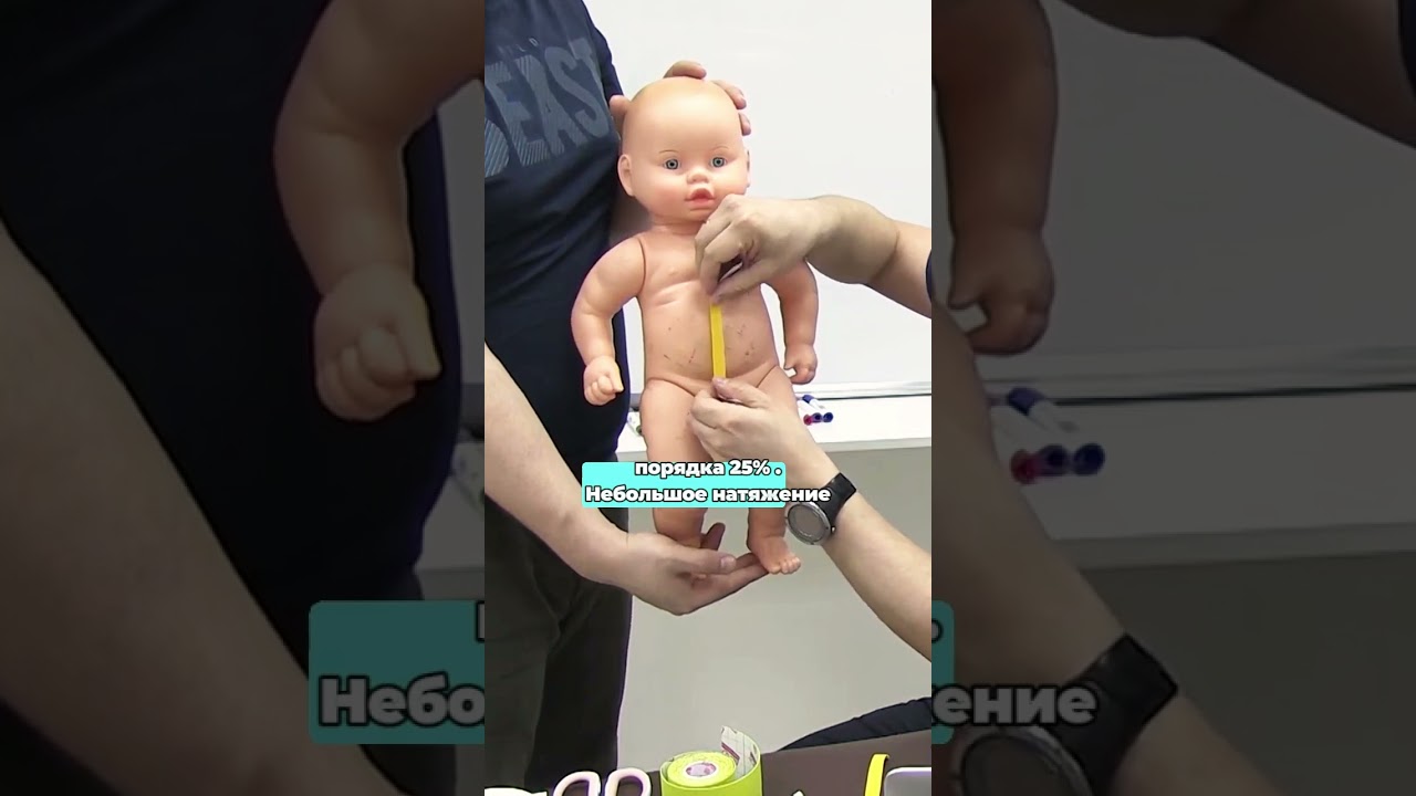 Как тейпировать пупочную грыжу младенцу? Показывает Валентин Гайт❤️