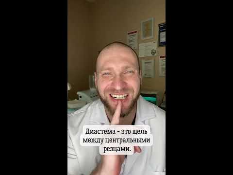 Бейне: Диастеманы қалай жабуға болады?