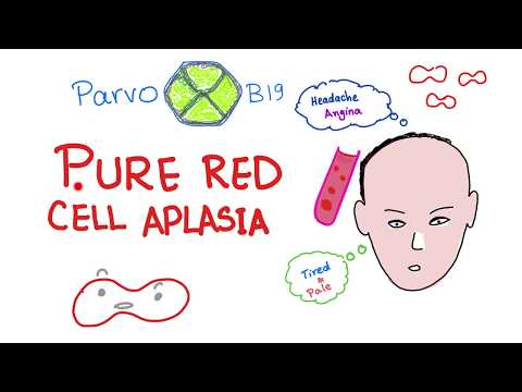 Pure Red Cell Aplasia