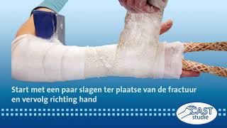 CAST studie: Instructie aanleg circulair gips screenshot 5