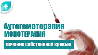 Аутогемотерапия монотерапия – лечение собственной кровью