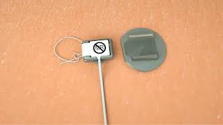 Download Lagu Cleaning \u0026 Caring for Your SPRINT PNS System MP3