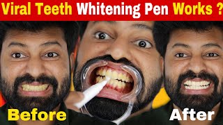 Teeth whitening pen Really Works  Genuine Review | Shadhik Azeez