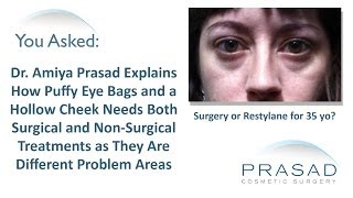 How Slightly Puffy Eyes Can Be Treated With Fillers, & Addressing The Cheek Area For Better Results
