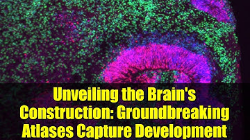 Unveiling the Brain