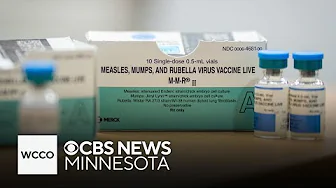 Spike in measles cases mostly affecting unvaccinated Minnesotans