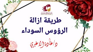 طريقة ازالة الرؤوس السوداء (الدرس الرابع) مسابقة تبييض الوجه ?