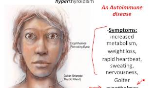Chapter 16- Thyroid gland