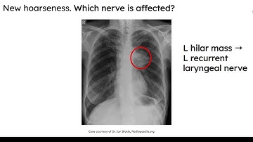 High Yield Radiology for USMLE Step 1: Adult Respiratory Part 2