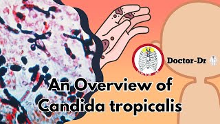 Candida tropicalis: Understanding the Basics of a Common Fungal Infection - Mycology Lectures