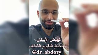 تبييض الأسنان بإستخدام التقويم الشفاف | الدكتور محمد الصفي