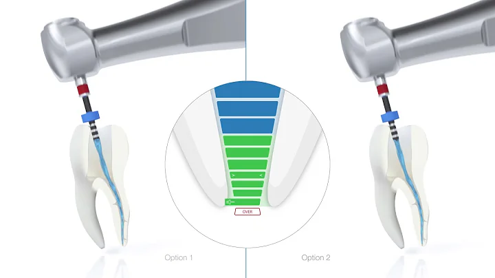 VDW Dental · How To: VDW.ROTATE – Schritt für Schritt