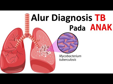 Video: Bagaimana Mendiagnosis Seorang Anak?