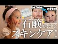 子供の肌トラブルはコレで解決!? Nico石鹸を使ってみたら効果が凄かった!