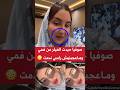 صوفيا حيدات الفيلر من فمها ومعجبهاش راسها