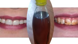وصفة طبيعية للاسنان لمحاربة اللثة ورائحة الفم و اصفرار الأسنان