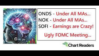 #ONDS #NOK #SOFI - HOT STOCK Technical Analysis