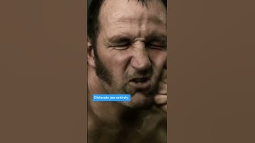 Sherlock Holmes sure knows how to discombobulate 🤕 #Shorts