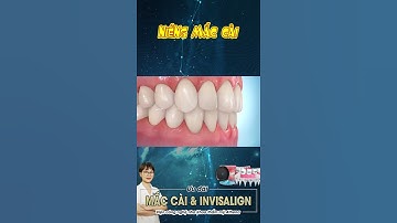 [3D] NIỀNG MẮC CÀI || Nha Khoa Quốc Tế Athena