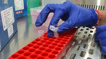 DiAGSure®HPV-16 High Risk Genotypes Extraction Kit ( from Urine)