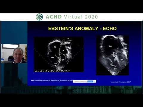 Video: Defect Cardiac Congenital (anomalia Ebstein) La Câini