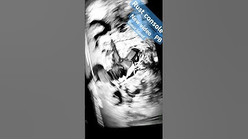 Rust console PB New Donut island