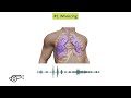 Abnormal lung sounds in copd