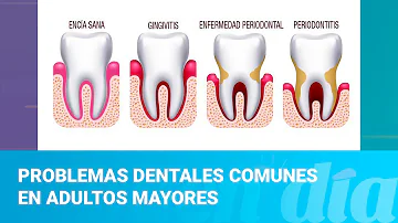 ¿Cuáles son los problemas bucodentales más frecuentes en las personas mayores?