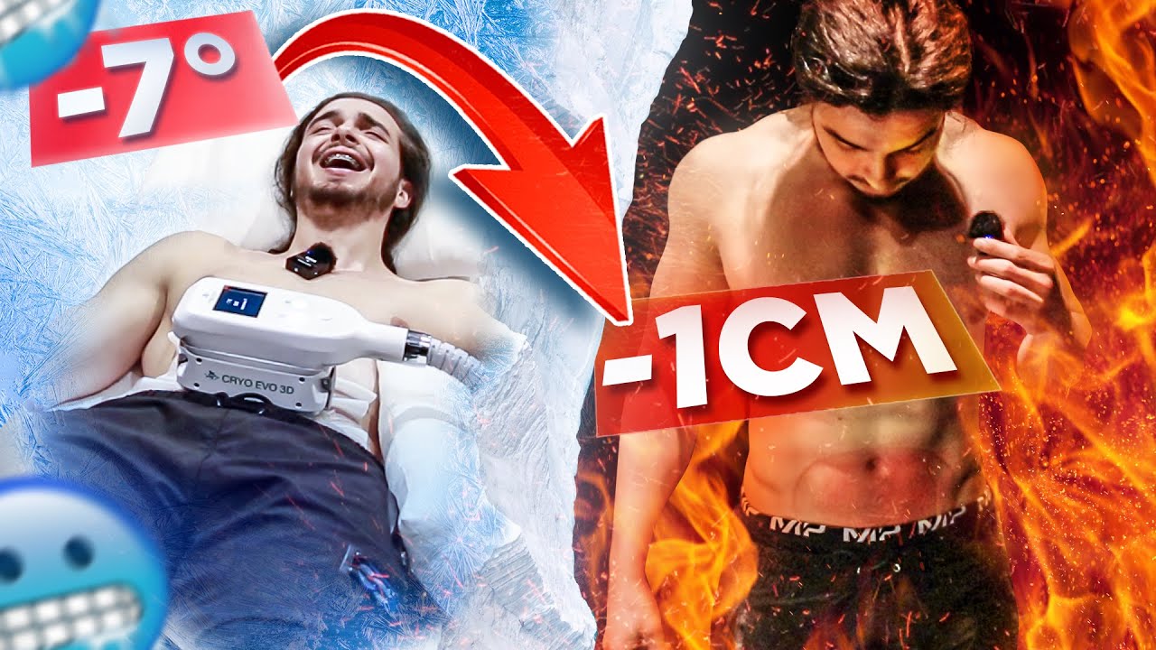 Je test la CRYOLIPOLYSE (réduire le gras par le froid)