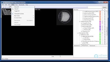 Brain Explorer video tutorial