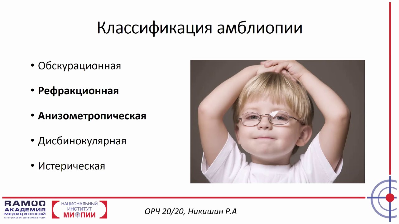 обскурационная амблиопия. амблиопия неврология. понятие амблиопии. амблиопия картинки. истерическая амблиопия.