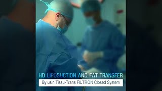 HD Liposuction and Fat Transfer - نحت الجسم عالى التحديد و اعادة حقن الدهون