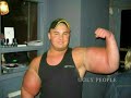 Victims of synthol or false kings of bodybuilding.