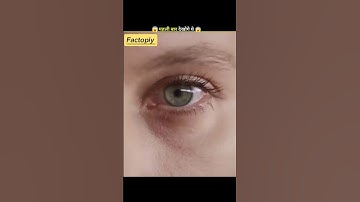 Why Do We Get Motion Sickness? The Science Explained!😱#shorts