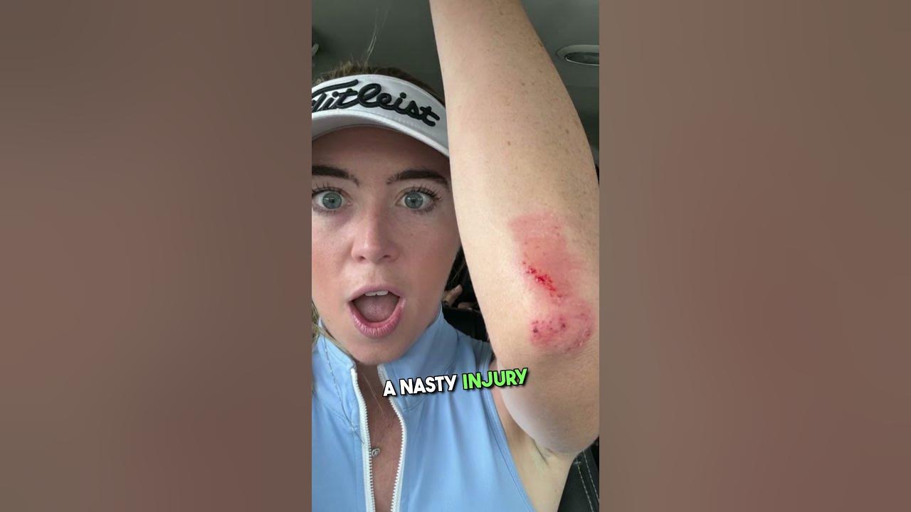 GraceCharisxo Nasty Injury 😢 ️🔥 YouTube GraceCharisxo Nasty Injury 😢 ️🔥 YouTube