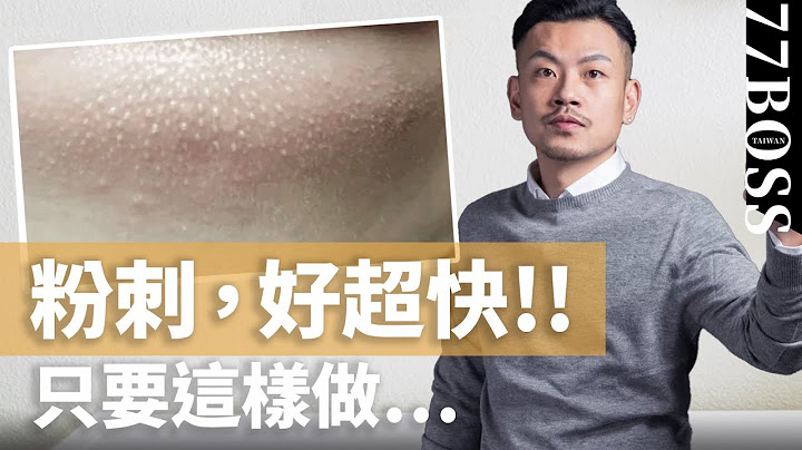 閉鎖粉刺要擠嗎？這樣做，粉刺好超快～～！！ 【77老大】 - 天天要聞