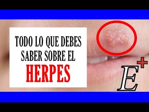 Vídeo: Recurrencia De Herpes Zóster: Lo Que Debe Saber