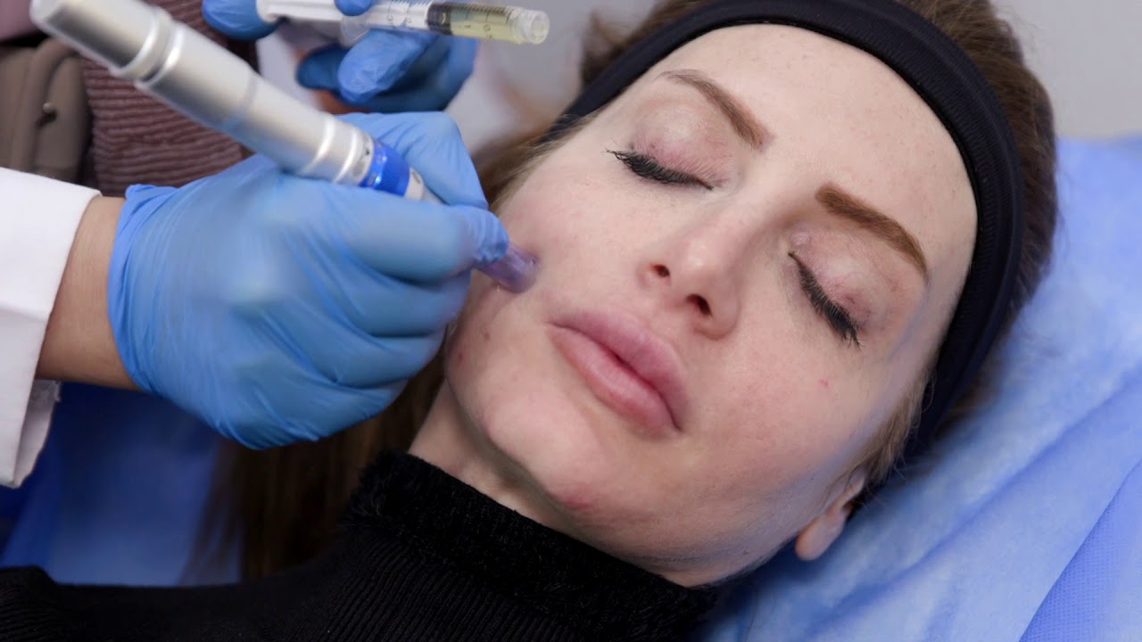 انواع واستخدامات الميزوثيرابي