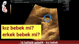 sik sorulan ultrasonda bebek cinsiyeti nasil belli olur anaokullari ve okul oncesi egitim