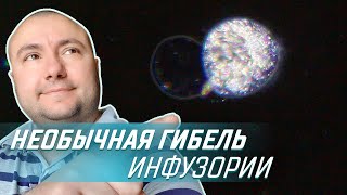 Необычная гибель инфузории | Темное поле