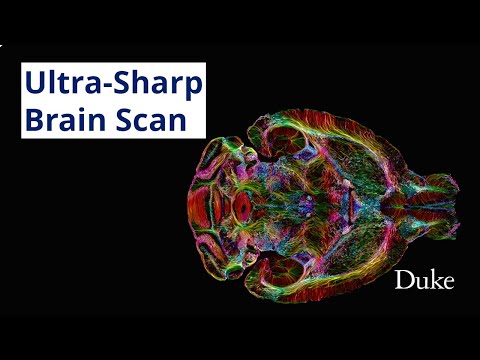 Ultra-Sharp Brain Scan