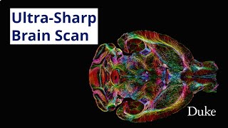 Ultra-Sharp Brain Scan