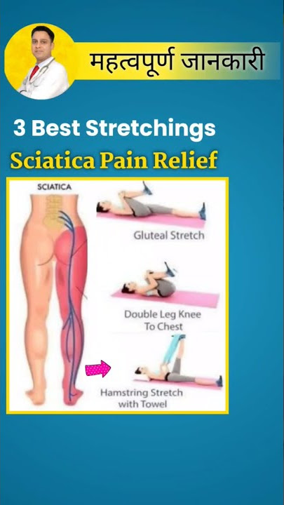 ✅Sciatica Pain Relief ✅ #shorts #physiodrdeepaksoni #sciatica