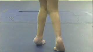 Video 50 5 Anteversion Femoral Aumentada