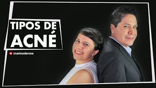 Tipos De Acné Dr. Marino Dermatólogo