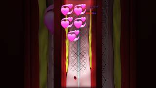 #animation #doctor #tranding #cardiacrehab #viral #upsc #motivation #heartdisease #angioplasty