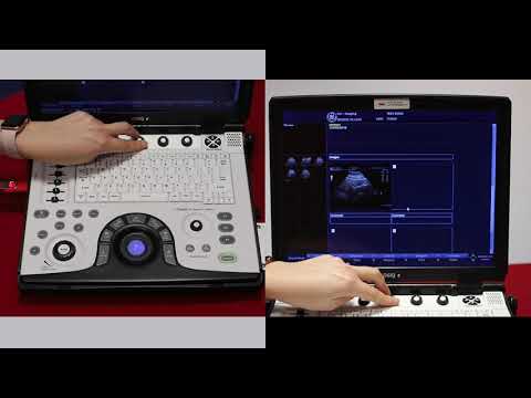 How to create a report on the GE logiq e ultrasound scanner - video 6